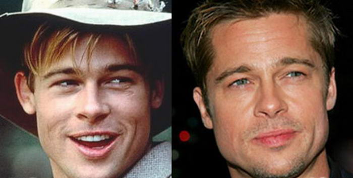 Brad Pitt - Cosmetic Surgeries